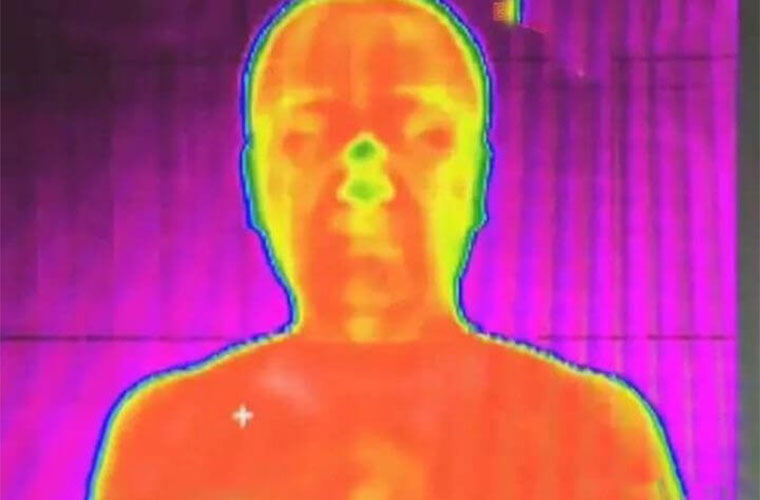 给中医“装”上一双“透视眼”：红外热像仪如何重塑古老中医的诊断逻辑？